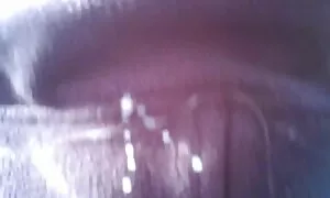 膿は陰茎の上部に薄いです 女の子 アダルト 無料 動画